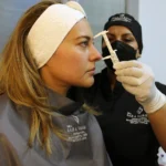 Dra Sara vargas Cirujana Plastica, cali colombia