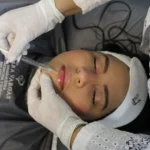 Dra Sara vargas Cirujana Plastica, cali colombia
